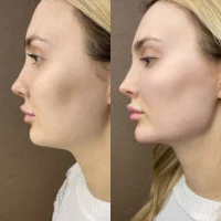 косметологическая студия miracle beauty фото 2 - liftinglica.ru