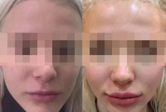 студия косметологии культ кожи фото 6 - liftinglica.ru
