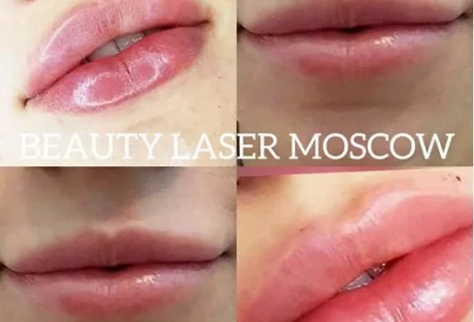 центр косметологии и дерматологии beauty laser фото 3 - liftinglica.ru