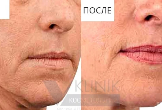 клиника эстетической косметологии v-klinik фото 1 - liftinglica.ru