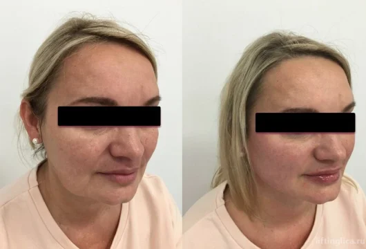 центр эстетической медицины красивая жизнь фото 19 - liftinglica.ru