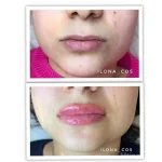 студия красивой кожи ilona cos фото 2 - liftinglica.ru