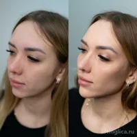 школа косметологии beauty mir фото 2 - liftinglica.ru