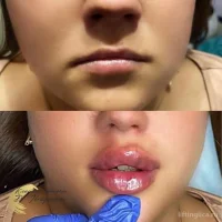 клиника доктора ибрагимовой фото 2 - liftinglica.ru