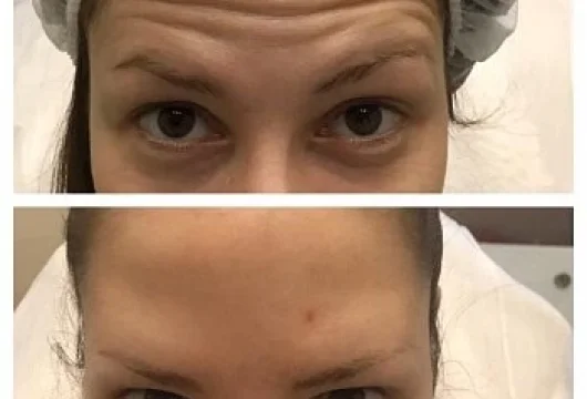 центр косметологии и эпиляции эпилсити на улице плющиха фото 9 - liftinglica.ru