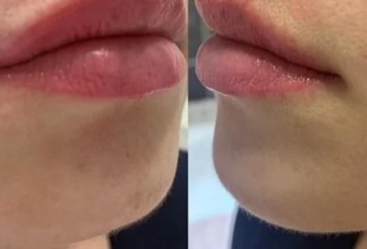 центр косметологии и эпиляции эпилсити на улице плющиха фото 1 - liftinglica.ru