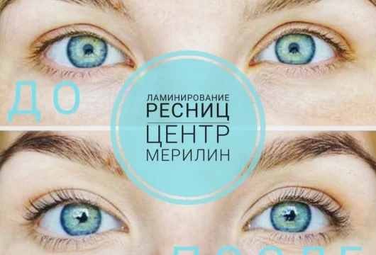 центр косметологии и перманентного макияжа мерилин фото 4 - liftinglica.ru