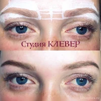 студия косметологии клевер фото 2 - liftinglica.ru