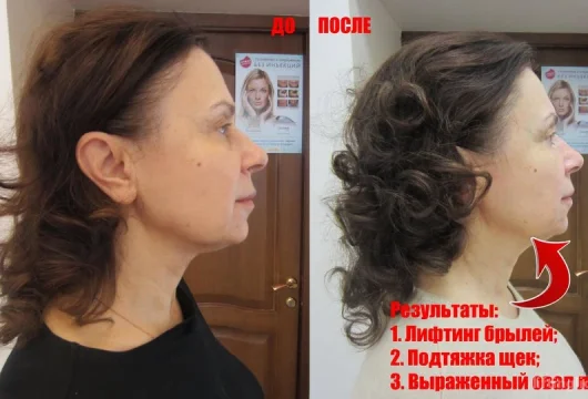 косметология mylin фото 6 - liftinglica.ru