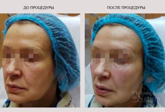 клиника косметологии и женского здоровья philosophia de natura фото 1 - liftinglica.ru
