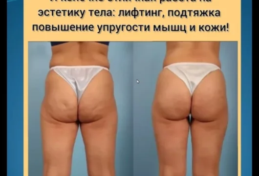кабинет коррекции фигуры фрея фото 11 - liftinglica.ru